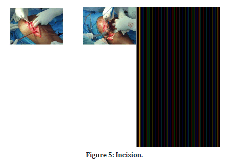 Medical-Dental-Incision