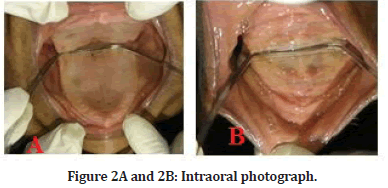 Medical-Dental-Intraoral