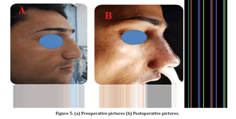 Medical-Dental-Postoperative