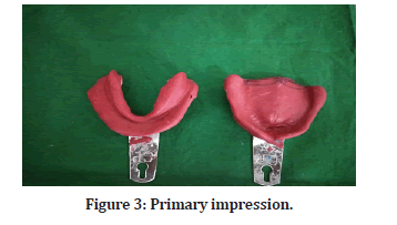 Medical-Dental-impression