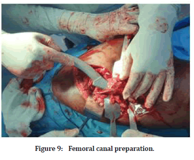 Medical-Dental-preparation