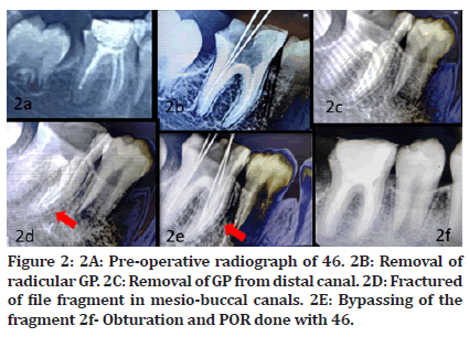 Medical-Dental-radiograph