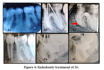 Medical-Dental-treatment