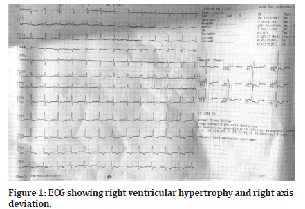 medical-dental-hypertrophy