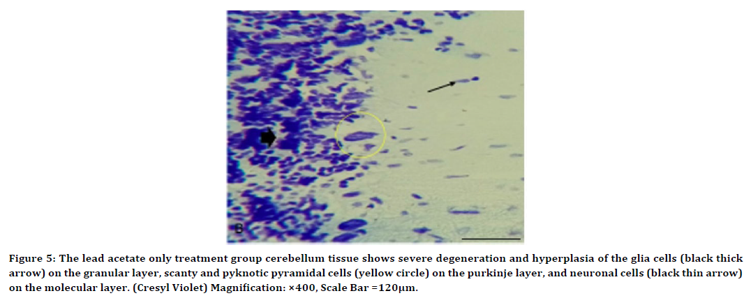 medical-dental-science-cerebellum-tissue