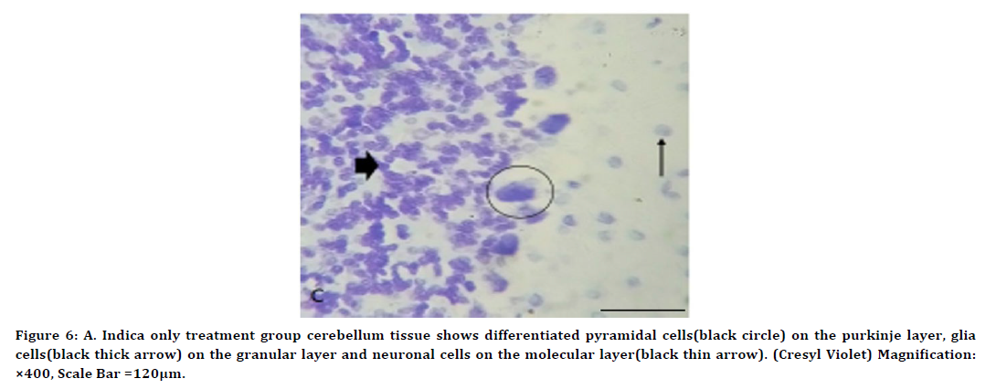 medical-dental-science-cerebellum-tissue