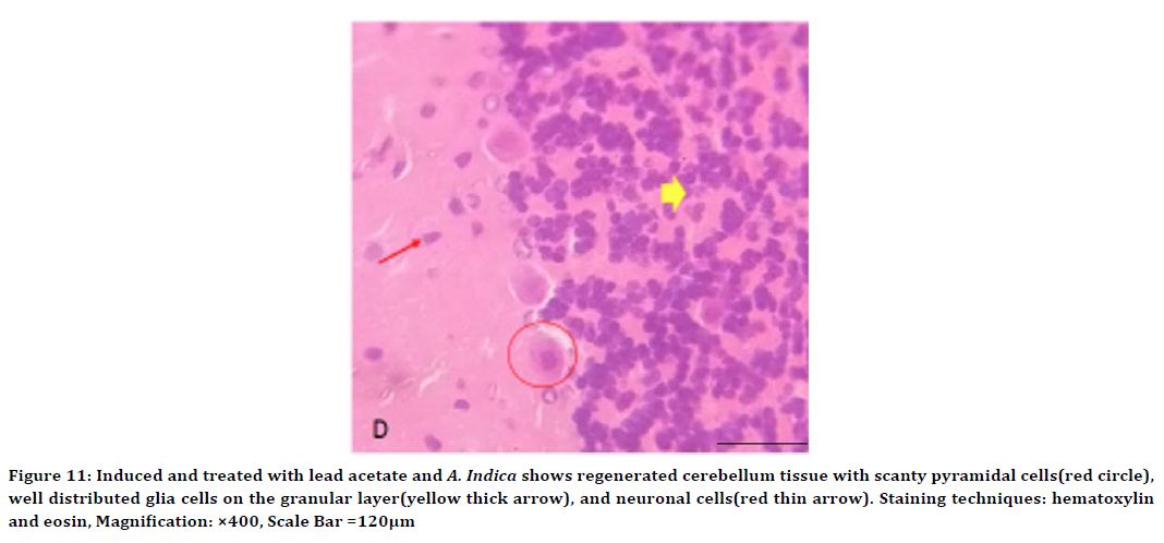 medical-dental-science-cerebellum-tissue