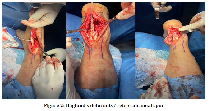 medical-dental-science-deformity