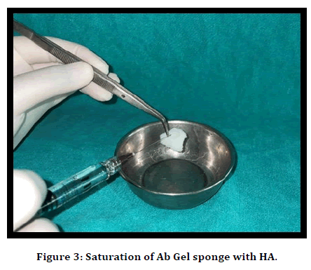 medical-dental-science-extraction-socket