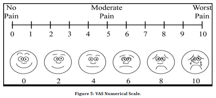 medical-dental-science-extraction-socket