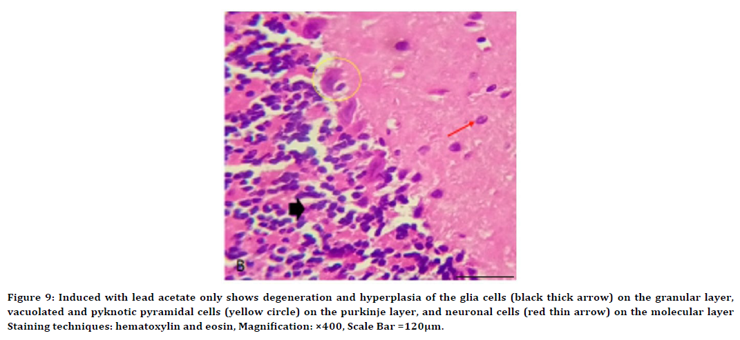 medical-dental-science-hyperplasia