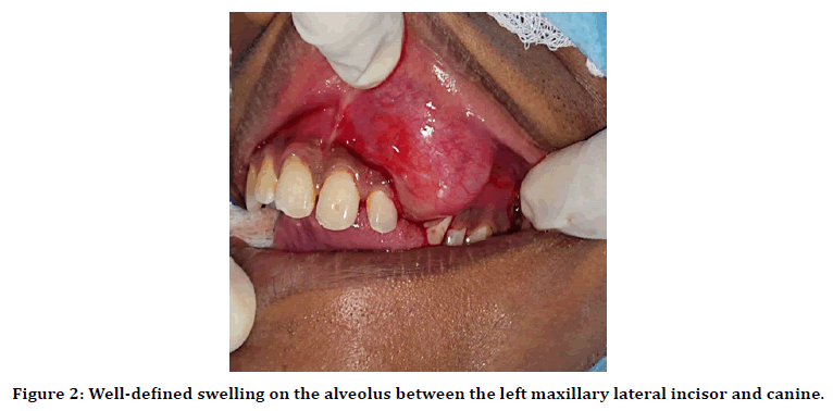 medical-dental-science-nasolabial-fold