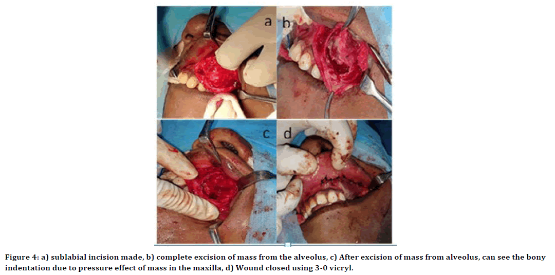 medical-dental-science-nasolabial-fold