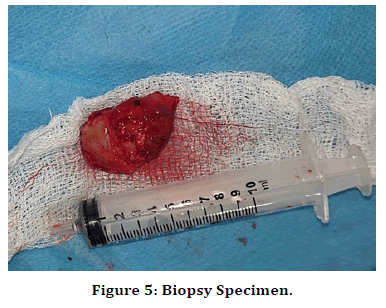 medical-dental-science-nasolabial-fold