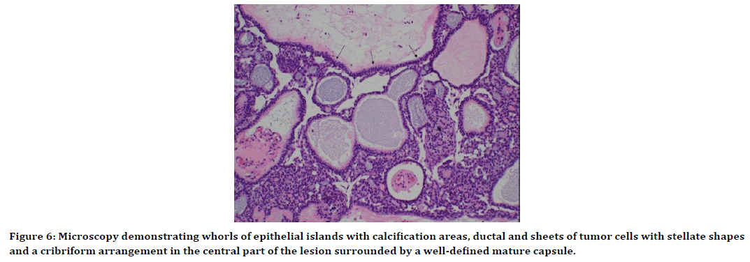 medical-dental-science-nasolabial-fold