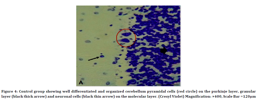 medical-dental-science-pyramidal-cells