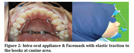 Medical-Dental-Facemask