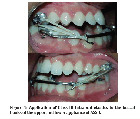 Medical-Dental-buccal