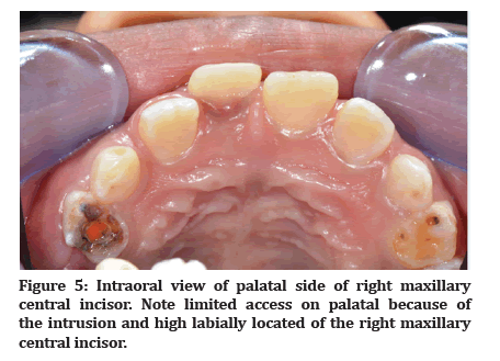 Medical-Dental-palatal