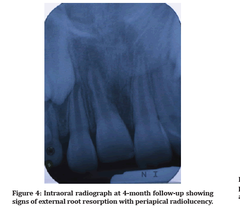 Medical-Dental-radiolucency