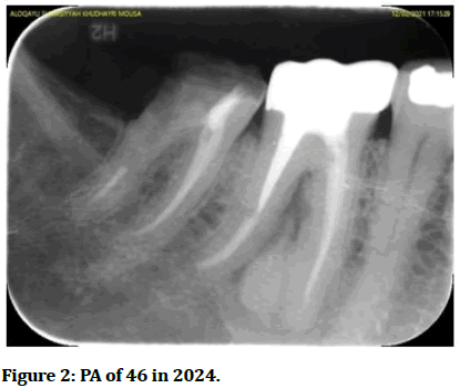 Research-Dental