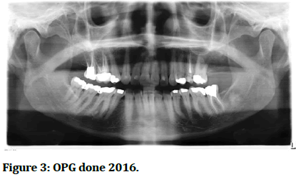 Research-Dental