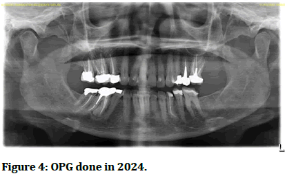 Research-Dental